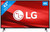 LG 43UN71006LB (2020)