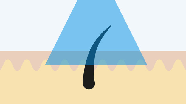 Faisceau laser large