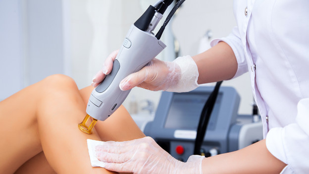 Laser : faisceaux laser, résultat permanent