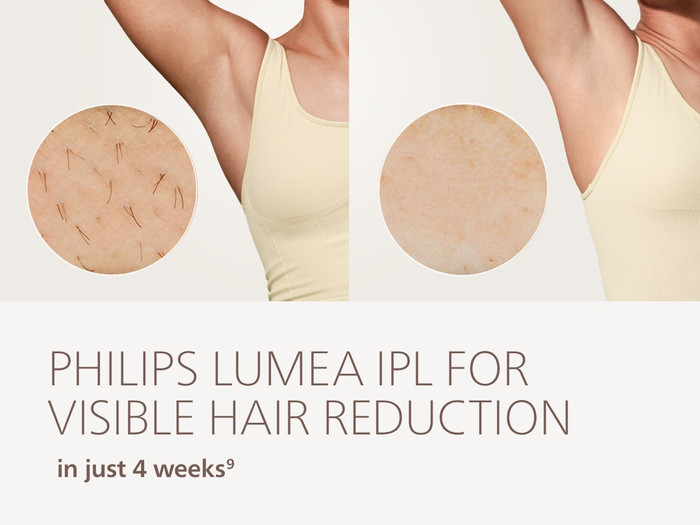 Philips Lumea IPL 8000 Series BRI934/00 visuel fournisseur